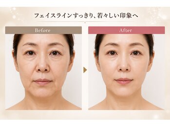 サロン ド ルポスの写真/結果重視の方におすすめ★本格小顔リフトアップ