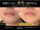 ダイヤ 名古屋中川区店(Daiya)の写真/「安さで選ぶより、失敗しない脱毛選び。」最短少ない回数で卒業を目指す設計メンズ脱毛｜ヒゲ・VIO特化