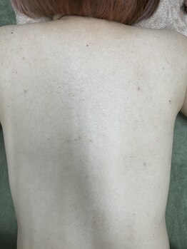 ナノハナ/鹿沼市の全身脱毛のナノハナ