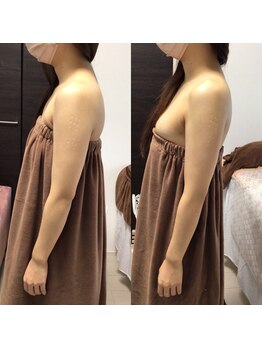 マイントゥー(mine too)/猫背、巻き肩解消☆