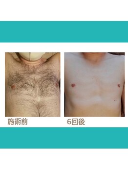 メンズ シンバ(SIMBA)/【Before→After】