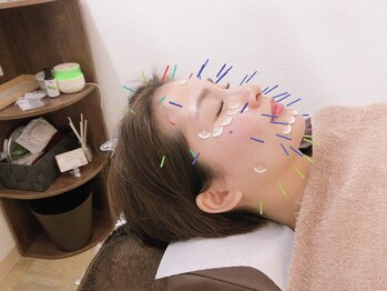 カラダフルピット鍼灸整体院/美容鍼