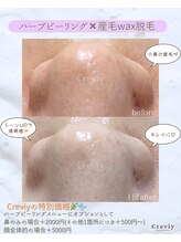 クレヴィー(Creviy)/New☆潤艶Wax脱毛(産毛脱毛)