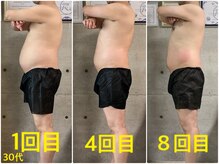 ペリー(PELLY)/男性30代　before after