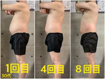 ペリー(PELLY)/男性30代 before after