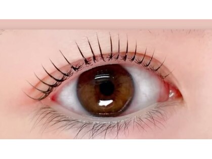 ナルナニ(nalu nani)の写真