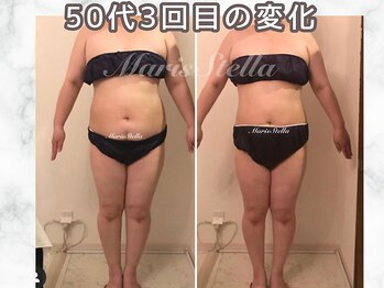 マリスステラ 天王寺(MarisStella)/セレクト痩身でお腹スッキリ
