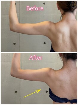 エクセレントビューティーサロン 艶(EN)/ブライダル１回