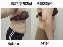 イセラ(ISELA)/