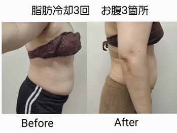 イセラ(ISELA)/