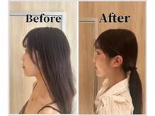 整体ラルース 中目黒(LALUZ)/20代 女性 頭蓋骨小顔矯正　変化