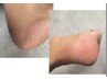 〈秋冬限定〉しっとり美かかと◆極上フットケア(角質ケア+保湿パック)