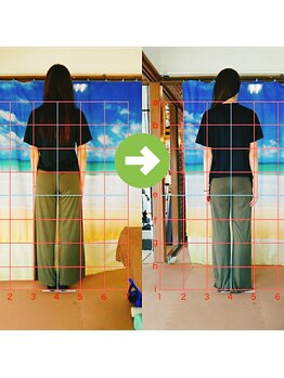 サプライズ整体院/30代ママさんの産後の骨盤初回