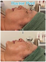 ネオズエゴ アーチ(neos ego Archi)/ダクトピール　ビフォーアフター