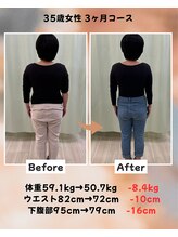 くさば整骨院/35歳女性/ダイエット3か月コース
