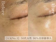 ディレイア ザ コスメ 有楽町マルイ店(direia the cosme)/ツヤ/目元のしわ/たるみ[有楽町]