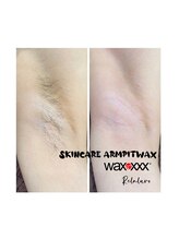 リラルボ(Relaluvo)/脇スキンケアwax脱毛