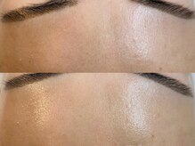 ブラン ネージュ(Blanc Neige)/マーメイドセルトリートメント