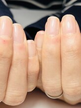 アイネイル(Ainail)/自爪育成コース2回目の方です