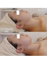 ミールーム(mi room)/レモンボトルフェイシャル