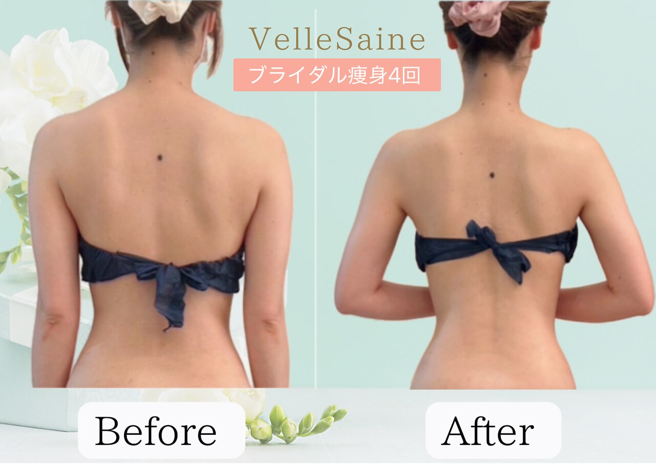 ヴェルセーヌ(VelleSaine)｜ホットペッパービューティー