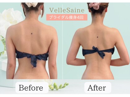 ヴェルセーヌ(VelleSaine)の写真