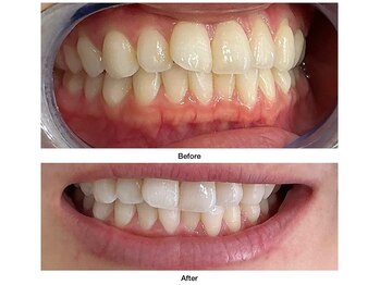 コアルナ センター北店(Coalna)/歯科提携・セルフホワイトニング