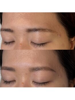 マナ ワクシング 海浜幕張(Mana waxing)/似合わせ眉毛ワックス/垢抜け/眉