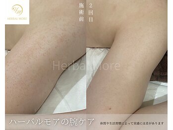 リンクプラスビューティー(RiMK plus beautY)/隠さなくてよい二の腕へ！