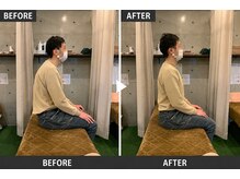 リセット整骨院しぎの院/BeforeAfter