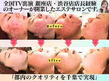 スノースキン(Snow skin)