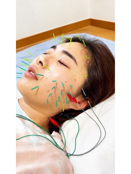 宮崎治療院の写真/【本格鍼灸×美容鍼】お身体の不調から美容のお悩みまで!オーダーメイド施術で健康と美をトータルサポート