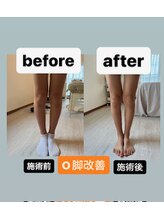 ヒナタ(HINATA)/キッズ整体　