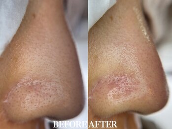 サロン ムスブ(salon MUSUBU)/山梨エステ/甲府エステ