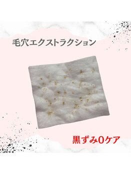 モエラビューティーサロン(Moela beauty salon)/【全顔毛穴洗浄】