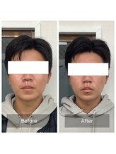 ハリナチュレ 那覇店(HARINATURE)/Before/After