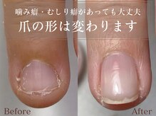 ナル(Nalu.)の雰囲気(あなたの爪も変わります◎自爪育成で自信を持てる指先へ…♪)