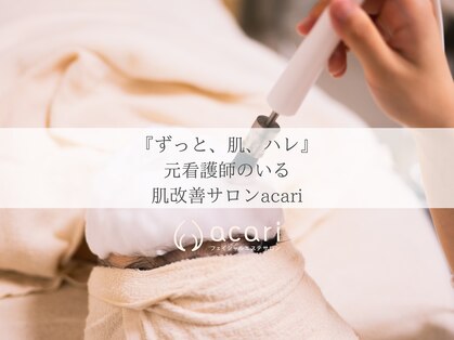 アカリ(acari)の写真