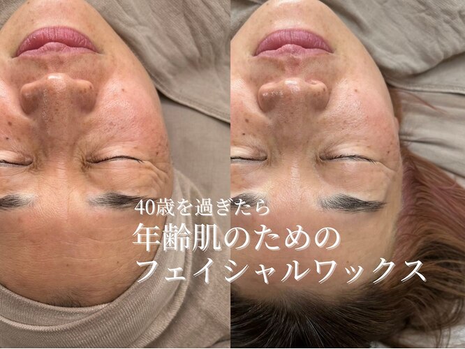 ハナワクシングプラス 高知(HanaWaxing+)｜ホットペッパービューティー