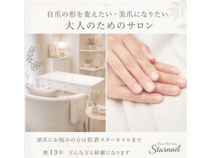 スターネイル(Starnail)の写真