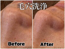 アンドエミニー エン ラボーテ(& EMINY 艶 la beaute)/毛穴洗浄