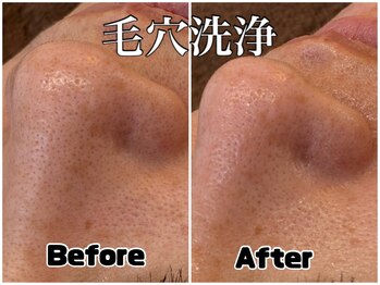 アンドエミニー エン ラボーテ(& EMINY 艶 la beaute)/毛穴洗浄