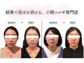 コリアンビューティーサロンリー(Lee)の写真/【Lee自慢の小顔コルギ♪】一度の体感がクセになる◎自分史上、最高の美小顔を体験してみませんか？/千葉