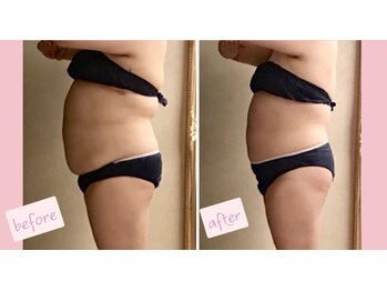 プレジール(Plaisir)/モナリザ＋フォース+脂肪分解