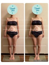 カレン/軟部組織のリリース