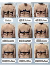 サロン ド ヴィーナス ビューティー(salon de Venus beaute)/背中痩せ／セル脂肪／痩身ケア