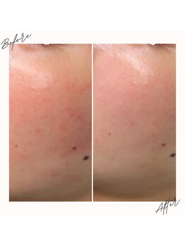 イチロクイチハチ(1618)/花粉で揺らぐ肌に