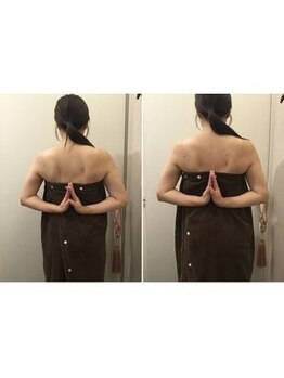 蕨整体院/肩甲骨はがし/ブライダル