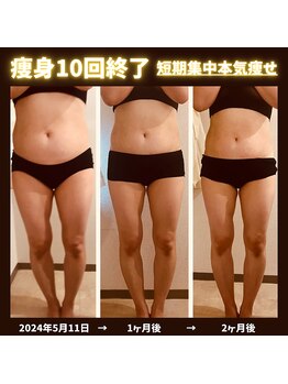 キュララ(KYURARA)/お腹を集中ケア！基礎代謝アップ