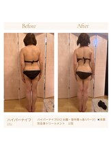 パチュプチ(Patchou petit)/Before→after／痩身